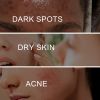 OUHOE Dark Spot Cream, Lightening Yellow Brown White Spot Cream Dark Spots Skin Tone Moisturize Skin